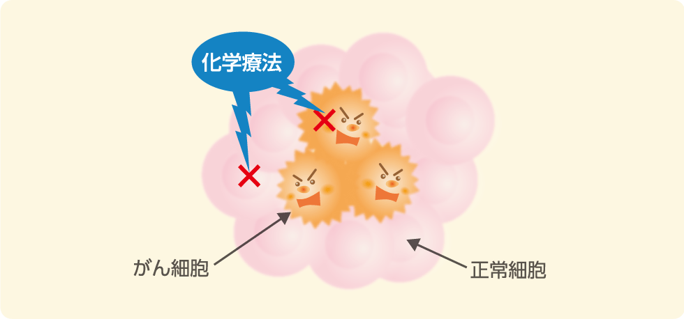 化学療法について
