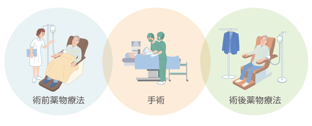 キイトルーダ®と化学療法併用による術前・術後薬物療法についてのイメージ