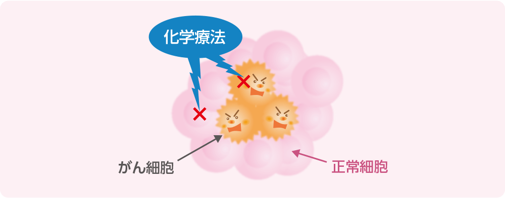 化学療法についてのイメージ