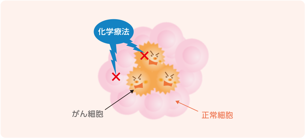 化学療法についてのイメージ
