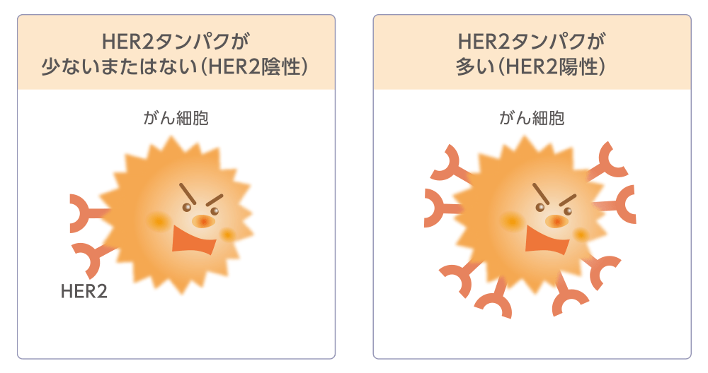 HER2検査についてのイメージ