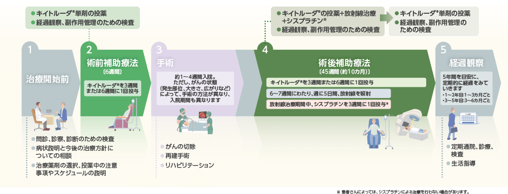 治療全体のスケジュール