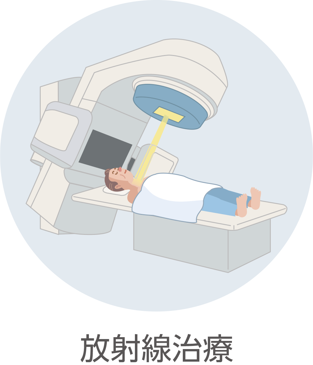 放射線治療