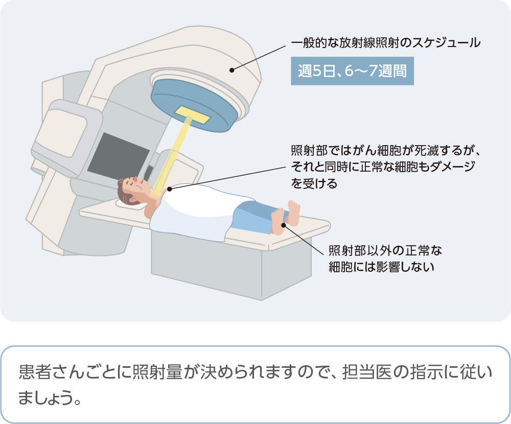 術後補助療法で用いられる放射線治療