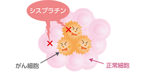 術後補助療法で用いられるシスプラチン