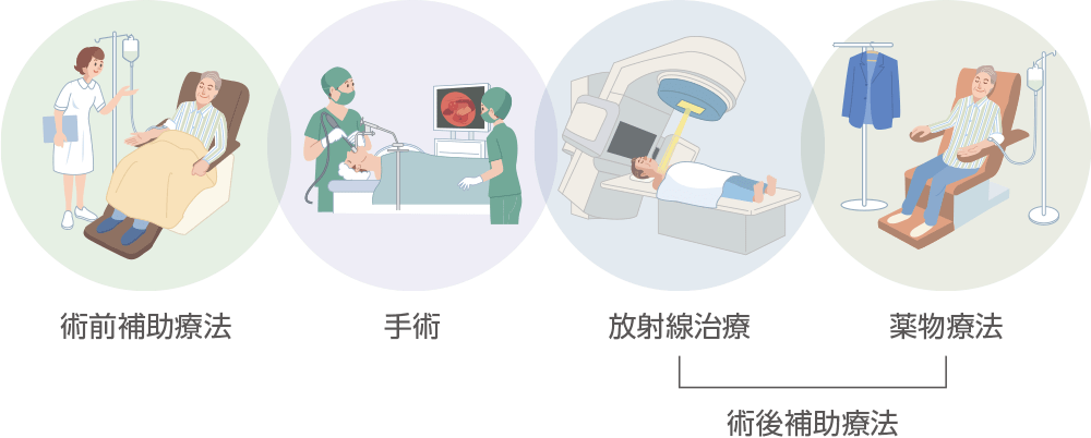 キイトルーダ®による術前・術後補助療法について