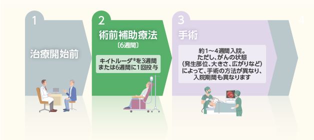 術前補助療法について（キイトルーダ®単剤療法）