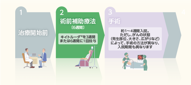 術前補助療法について（キイトルーダ®単剤療法）