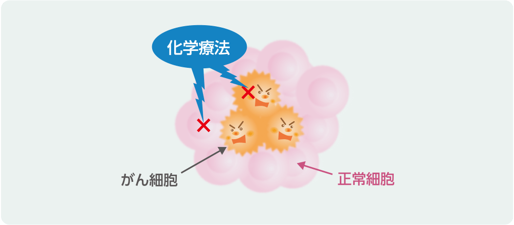 化学療法についてのイメージ